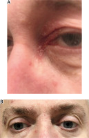 https://reu.termedia.pl/f/fulltexts/217810/RU-64-3-217810-g001_min.jpg