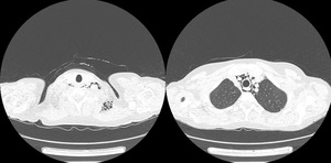 Figure from article: Different faces...