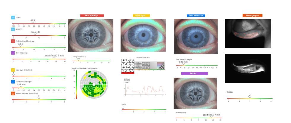 Figure from article: Modern diagnostics for dry...